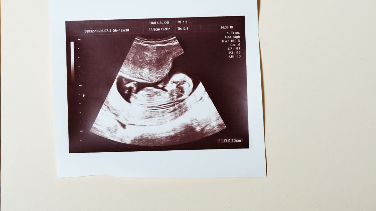 MISSOURI SENATE READY TO DITCH RADICAL ABORTION AMENDMENT...🚪(What’s the next move?)